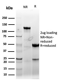 SDS-PAGE Analysis Purified Cyclin E Recombinant Rabbit Monoclonal Antibody (CCNE1/4935R). Confirmation of Purity and Integrity of Antibody.