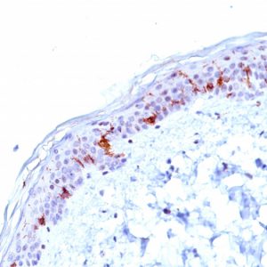 Formalin-fixed, paraffin-embedded human Skin stained with CD1a Mouse Monoclonal Antibody (O10).