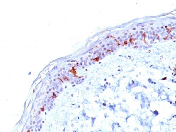 Formalin-fixed, paraffin-embedded human Skin stained with CD1a Mouse Monoclonal Antibody (O10).