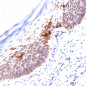 Formalin-fixed, paraffin-embedded human Skin stained with CD1a Monoclonal Antibody (SPM120).