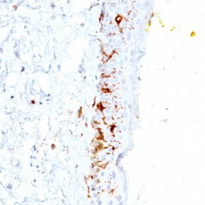 Formalin-fixed, paraffin-embedded human Skin stained with CD1a Mouse Monoclonal Antibody (C1A/711).