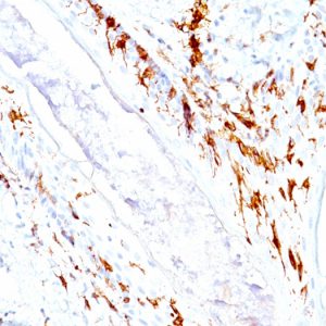 Formalin-fixed, paraffin-embedded human Skin stained with CD1a Monoclonal Antibody (O10+C1A/711).