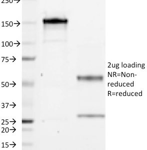 SDS-PAGE Analysis of Purified CD1a Mouse Monoclonal Antibody (CB-T6). Confirmation of Integrity and Purity of Antibody.