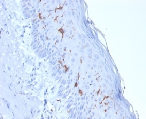 Formalin-fixed, paraffin-embedded human skin stained with  CD1a Mouse Recombinant Monoclonal Antibody (rC1A/711). HIER: Tris/EDTA, pH9.0, 45min. 2°C: HRP-polymer, 30min. DAB, 5min.