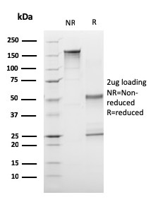 SDS-PAGE Analysis of Purified CD1a Mouse Monoclonal Antibody (C1A/3249). Confirmation of Purity and Integrity of Antibody.
