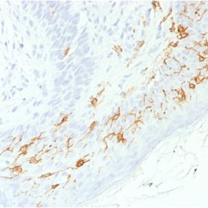 Formalin-fixed, paraffin-embedded human Skin stained with CD1a-Monospecific RecombinantRabbit Monoclonal Antibody (C1A/1506R).
