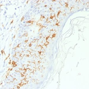 Formalin-fixed, paraffin-embedded human Skin stained with CD1a Rabbit Polyclonal Antibody.