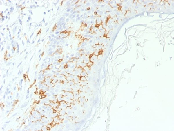 Formalin-fixed, paraffin-embedded human Skin stained with CD1a Rabbit Polyclonal Antibody.