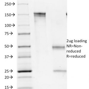 SDS-PAGE Analysis of Purified CD1b Mouse Monoclonal Antibody (100-1A5). Confirmation of Integrity and Purity of Antibody.