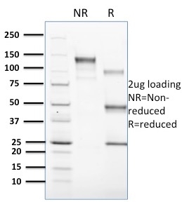 SDS-PAGE Analysis of Purified CD1c Mouse Monoclonal Antibody (CD1C/1603). Confirmation of Purity and Integrity of Antibody.