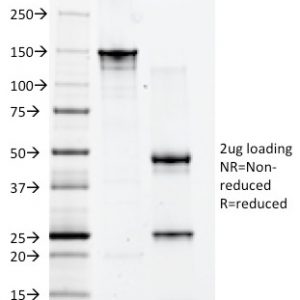 SDS-PAGE Analysis of Purified CD2 Mouse Monoclonal Antibody (1E7E8.G4). Confirmation of Integrity and Purity of Antibody.