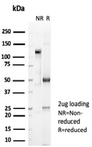SDS-PAGE Analysis of Purified CD2 Mouse Monoclonal Antibody (LFA2/7100). Confirmation of Purity and Integrity of Antibody.