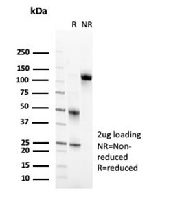 SDS-PAGE Analysis Purified CD2 Mouse Monoclonal Antibody (LFA2/7102). Confirmation of Purity and Integrity of Antibody.