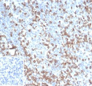 IHC analysis of formalin-fixed, paraffin-embedded human tonsil.  Cell surface stained with CD2 Mouse Monoclonal (LFA2/7104)  Inset: PBS instead of primary antibody; secondary only negative control.
