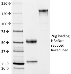 SDS-PAGE Analysis of Purified CD2 Mouse Monoclonal Antibody (BH1). Confirmation of Integrity and Purity of Antibody.