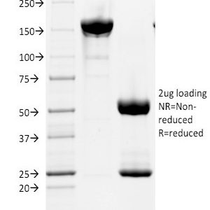 SDS-PAGE Analysis of Purified CD2 Mouse Monoclonal Antibody (HuLy-m1). Confirmation of Integrity and Purity of Antibody.