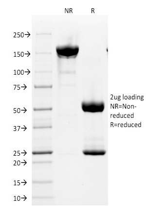 SDS-PAGE Analysis of Purified CD2 Mouse Monoclonal Antibody (HuLy-m1). Confirmation of Integrity and Purity of Antibody.