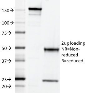 SDS-PAGE Analysis of Purified CD2 Mouse Monoclonal Antibody (RPA-2.10). Confirmation of Integrity and Purity of Antibody.