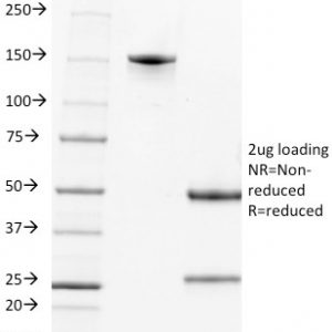 SDS-PAGE Analysis of Purified CD2 Mouse Monoclonal Antibody (LFA2/600). Confirmation of Integrity and Purity of Antibody.