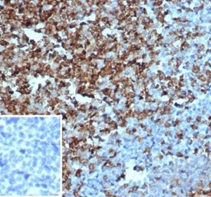 Formalin-fixed, paraffin-embedded human tonsil stained with CD2 Recombinant Rabbit Monoclonal Antibody (LFA2/3417R). Inset: PBS instead of primary antibody; secondary only negative control.