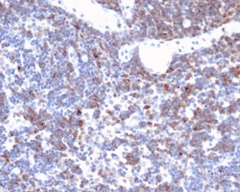 Formalin-fixed, paraffin-embedded human lymph node stained with CD2 Recombinant Rabbit Monoclonal Antibody (LFA2/3417R). HIER: Tris/EDTA, pH9.0, 45min. 2 °: HRP-polymer, 30min. DAB, 5min.