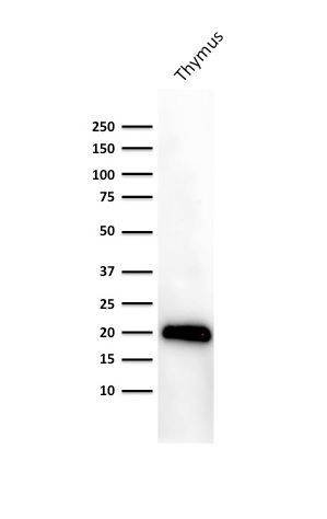 Western Blot Analysis of human Thymus lysate using Purified CD3e Mouse Monoclonal Antibody (PC3/188A).
