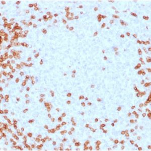 Formalin-fixed, paraffin-embedded human Spleen stained with CD3e Mouse Monoclonal Antibody (C3e/1931).