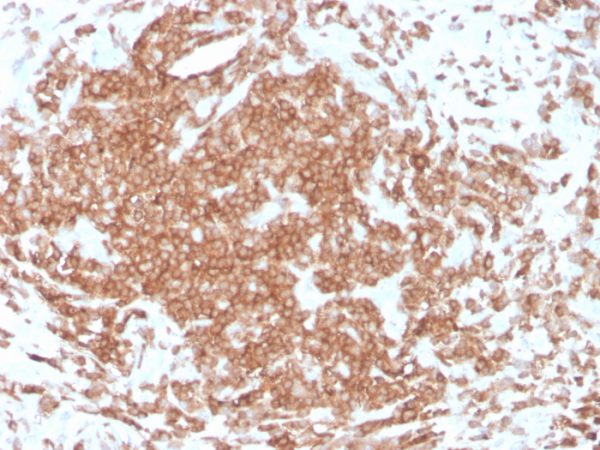 Formalin-fixed, paraffin-embedded human tonsil stained with CD3e Recombinant Mouse Monoclonal Antibody (rC3e/1308).