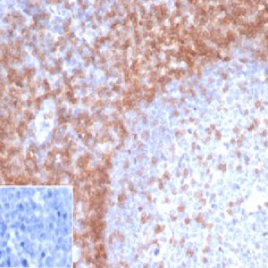 Formalin-fixed, paraffin-embedded human tonsil stained with CD3e Recombinant Mouse Monoclonal Antibody (rC3e/1931) at 2ug/ml. Inset: PBS instead of primary antibody, secondary control.