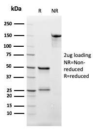 SDS-PAGE Analysis of Purified CD3e Recombinant Mouse Monoclonal Antibody (rC3e/2479). Confirmation of Integrity and Purity of Antibody.
