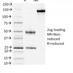 SDS-PAGE Analysis of Purified CD3e Mouse Monoclonal Antibody (OKT3). Confirmation of Purity and Integrity of Antibody.