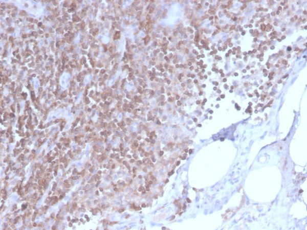 Formalin-fixed, paraffin-embedded human lymph node stained with CD3e Rabbit Recombinant Monoclonal Antibody (C3e/2858R).