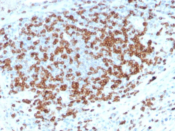 Formalin-fixed, paraffin-embedded human tonsil stained with CD3e Rabbit Recombinant Monoclonal Antibody (C3e/3125R).