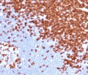 Formalin-fixed, paraffin-embedded human lymph node stained with CD3e Recombinant Rabbit Monoclonal Antibody (C3e/4652R).