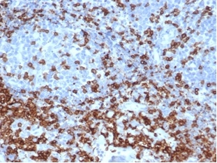 IHC analysis of formalin-fixed, paraffin-embedded human tonsil.  Strong cell surface staining using C3e/4652R at 2ug/ml in PBS for 30min RT. HIER: Tris/EDTA, pH9.0, 45min. 2 °: HRP-polymer, 30min. DAB, 5min.