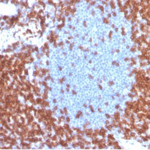 Formalin-fixed, paraffin-embedded human tonsil stained with CD3e Recombinant Rabbit Monoclonal Antibody (CD3e/4653R) at 2ug/ml. HIER: Tris/EDTA, pH9.0, 45min. 2°C: HRP-polymer, 30min. DAB, 5min.