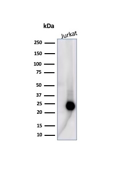 Western Blot Analysis of human Jurkat cell lysate using CD3e Recombinant Rabbit Monoclonal Antibody (C3e/4653R).