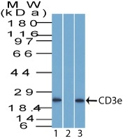 Western blot of CD3e in human Jurkat cells (1) absence and (2) presence of immunizing peptide. (3) Mouse thymus probed with CD3e Rabbit Polyclonal Antibody.