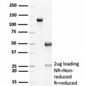 SDS-PAGE Analysis of Purified RCAS1 Recombinant Rabbit Monoclonal Antibody (EBAG9/7033R). Confirmation of Purity and Integrity of Antibody.