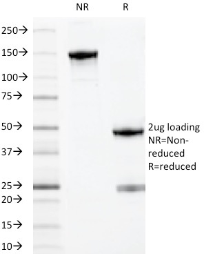 SDS-PAGE Analysis of Purified MYADM Mouse Monoclonal Antibody (MYADM/971). Confirmation of Purity and Integrity of Antibody.