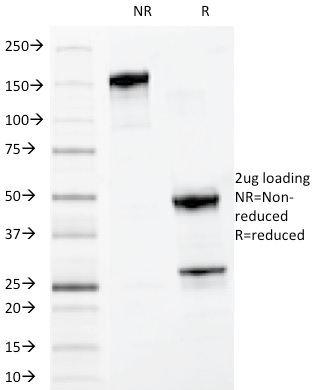 SDS-PAGE Analysis of Purified MYDAM Monoclonal Antibody (MYADM/972). Confirmation of Purity and Integrity of Antibody.