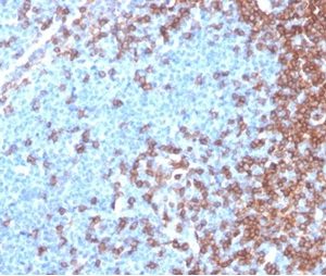 Formalin-fixed, paraffin-embedded human lymph node stained with CD4 Recombinant Mouse Monoclonal Antibody (rCD4/3930). HIER: Tris/EDTA, pH9.0, 45min. 2 °: HRP-polymer, 30min. DAB, 5min.