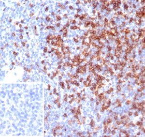 Formalin-fixed, paraffin-embedded human tonsil stained with CD4 Mouse Monoclonal Antibody (CD4/7142). Inset: PBS instead of primary antibody; secondary only negative control.
