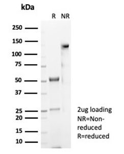 SDS-PAGE Analysis of Purified CD4 Mouse Monoclonal Antibody (CD4/7144). Confirmation of Purity and Integrity of Antibody.