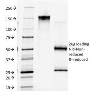 SDS-PAGE Analysis of Purified CD4 Mouse Monoclonal Antibody (EDU-2). Confirmation of Integrity and Purity of Antibody.