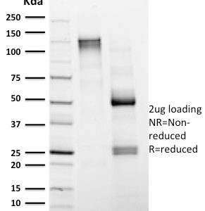 SDS-PAGE Analysis of Purified CD4 Mouse Monoclonal Antibody (CD4/1604). Confirmation of Integrity and Purity of Antibody.