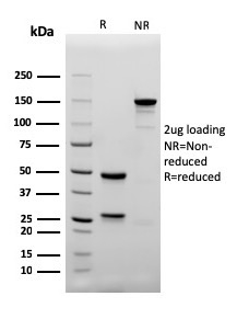 SDS-PAGE Analysis of Purified CD4 Recombinant Mouse Monoclonal Antibody (rC4/206). Confirmation of Integrity and Purity of Antibody.