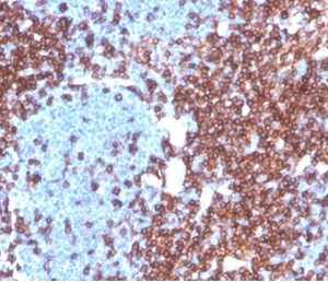 Formalin-fixed, paraffin-embedded human lymph node stained with CD4 Recombinant Rabbit Monoclonal Antibody (CD4/3619R) at 2ug/ml. HIER: Tris/EDTA, pH9.0, 45min. 2°C: HRP-polymer, 30min. DAB, 5min.