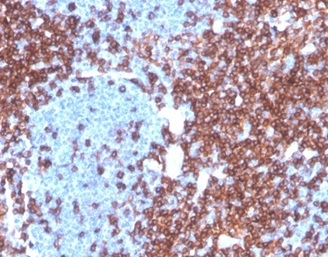 Formalin-fixed, paraffin-embedded human lymph node stained with CD4 Recombinant Rabbit Monoclonal Antibody (CD4/3619R) at 2ug/ml. HIER: Tris/EDTA, pH9.0, 45min. 2 °: HRP-polymer, 30min. DAB, 5min.