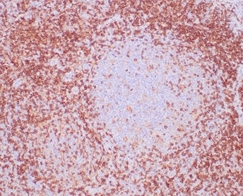 Formalin-fixed, paraffin-embedded human lymph node stained with CD4 Recombinant Rabbit Monoclonal Antibody (CD4/3619R) at 2ug/ml. HIER: Tris/EDTA, pH9.0, 45min. 2 °: HRP-polymer, 30min. DAB, 5min.